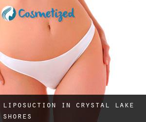 Liposuction in Crystal Lake Shores