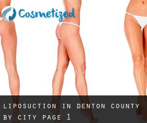 Liposuction in Denton County by city - page 1