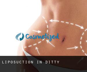 Liposuction in Ditty