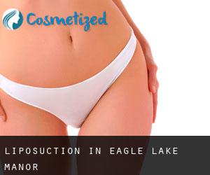 Liposuction in Eagle Lake Manor