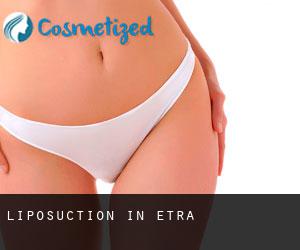 Liposuction in Etra