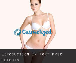 Liposuction in Fort Myer Heights