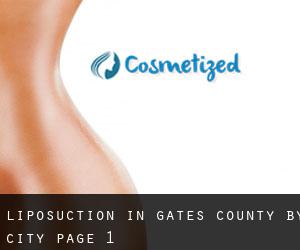 Liposuction in Gates County by city - page 1
