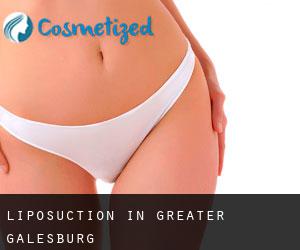 Liposuction in Greater Galesburg