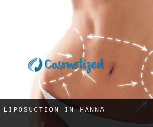 Liposuction in Hanna