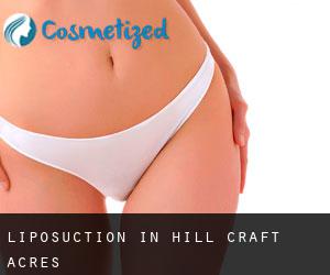 Liposuction in Hill Craft Acres