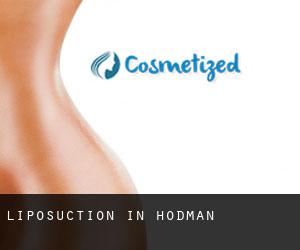 Liposuction in Hodman