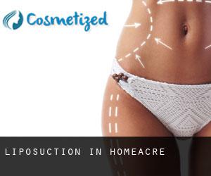 Liposuction in Homeacre