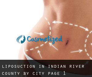 Liposuction in Indian River County by city - page 1