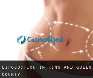 Liposuction in King and Queen County