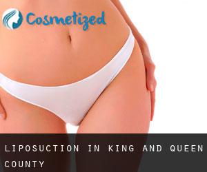 Liposuction in King and Queen County