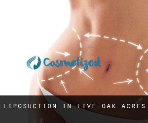 Liposuction in Live Oak Acres