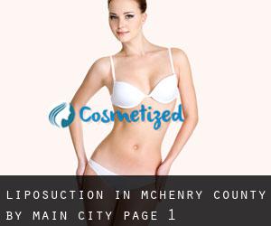 Liposuction in McHenry County by main city - page 1