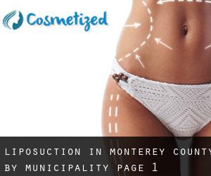 Liposuction in Monterey County by municipality - page 1