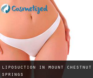 Liposuction in Mount Chestnut Springs