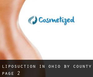 Liposuction in Ohio by County - page 2