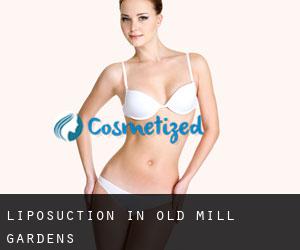 Liposuction in Old Mill Gardens