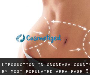 Liposuction in Onondaga County by most populated area - page 3