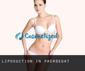 Liposuction in Paerdegat