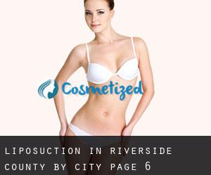 Liposuction in Riverside County by city - page 6