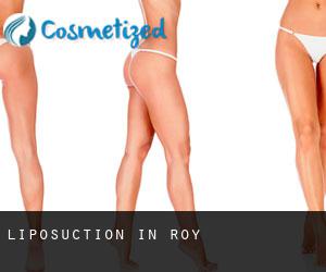 Liposuction in Roy