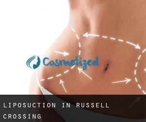 Liposuction in Russell Crossing