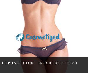 Liposuction in Snidercrest