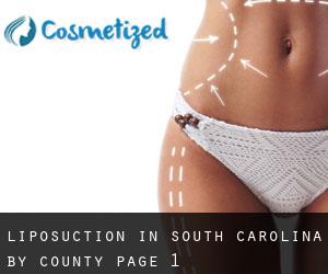Liposuction in South Carolina by County - page 1