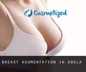 Breast Augmentation in Adela