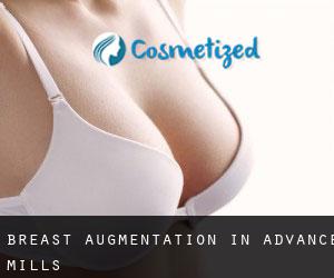 Breast Augmentation in Advance Mills