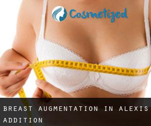 Breast Augmentation in Alexis Addition