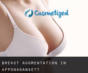 Breast Augmentation in Apponagansett