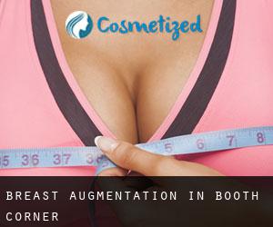 Breast Augmentation in Booth Corner