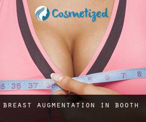 Breast Augmentation in Booth
