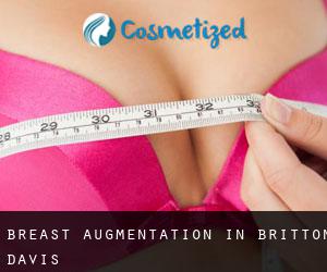 Breast Augmentation in Britton Davis