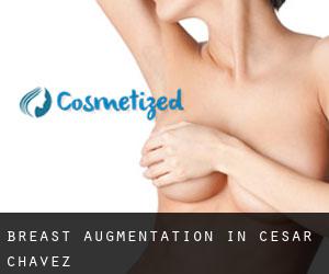 Breast Augmentation in César Chávez