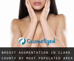 Breast Augmentation in Clark County by most populated area - page 3