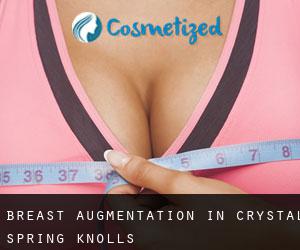 Breast Augmentation in Crystal Spring Knolls
