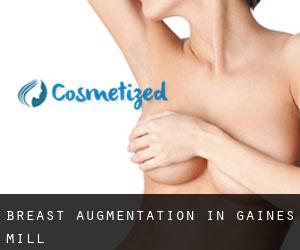 Breast Augmentation in Gaines Mill
