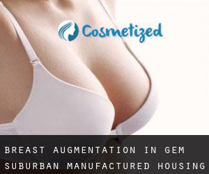 Breast Augmentation in Gem Suburban Manufactured Housing Community