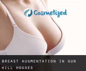 Breast Augmentation in Gun Hill Houses