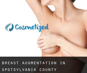 Breast Augmentation in Spotsylvania County