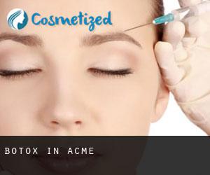 Botox in Acme