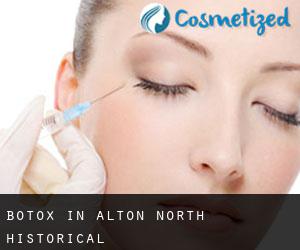 Botox in Alton North (historical)
