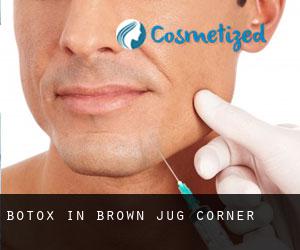 Botox in Brown Jug Corner