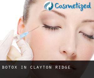 Botox in Clayton Ridge