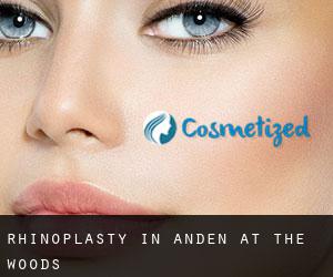 Rhinoplasty in Anden at the Woods