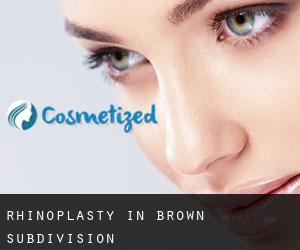 Rhinoplasty in Brown Subdivision