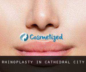 Rhinoplasty in Cathedral City