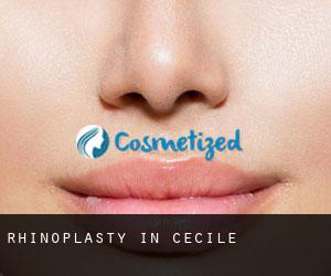 Rhinoplasty in Cecile